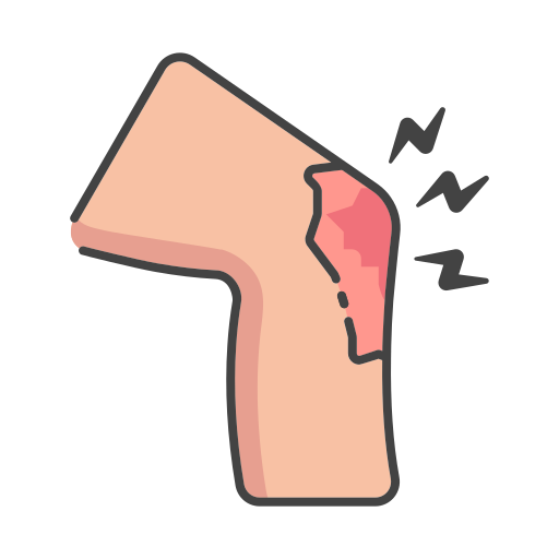 Knee Pain